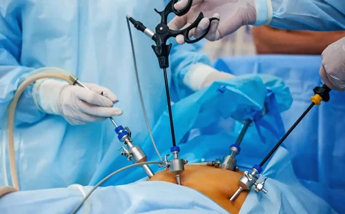 Laparoscopic Surgery in Pimpri Chinchwad
